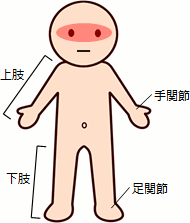 高度障害状態（両眼の視力）