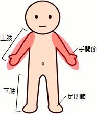 高度障害状態（両上肢）